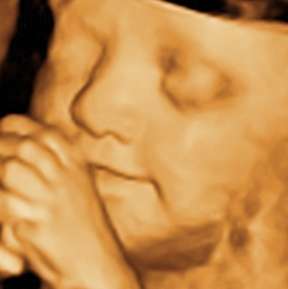 Love View 3D/4D Ultrasound Studio, LLC | 32222 Tamina Rd Suite A5, Magnolia, TX 77354 | Phone: (936) 524-9737