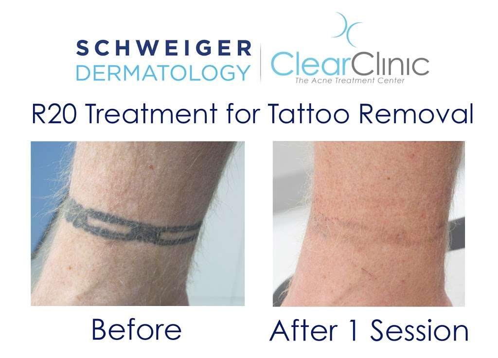 Schweiger Dermatology Group - Yonkers | 35 E Grassy Sprain Rd Suite #507, Yonkers, NY 10710, USA | Phone: (646) 665-3635