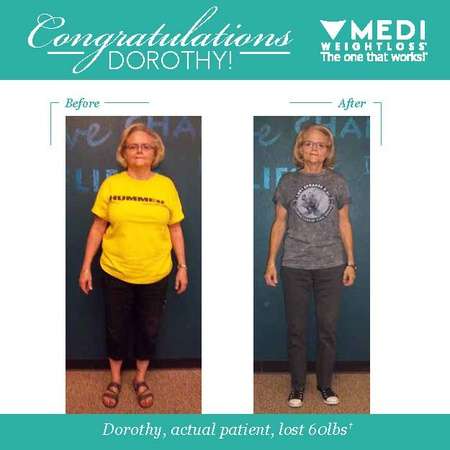 Medi-Weightloss | 8706 Fredericksburg Rd Suite 102, San Antonio, TX 78240, USA | Phone: (210) 697-9500