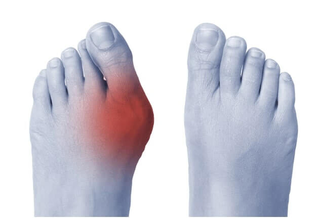 Foot Pain Therapy | 220A St Nicholas Ave, Brooklyn, NY 11237, USA | Phone: (323) 486-6008