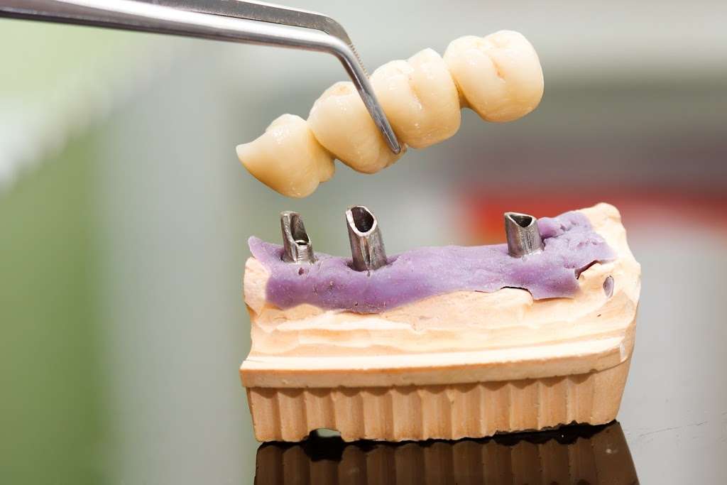 Microdent Dental Lab | 604 S Frederick Ave # 307, Gaithersburg, MD 20877, USA | Phone: (301) 519-0034