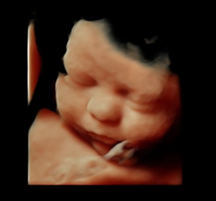 Baby Bump Ultrasound | 7110 E McDonald Dr b6, Scottsdale, AZ 85253 | Phone: (480) 219-9066