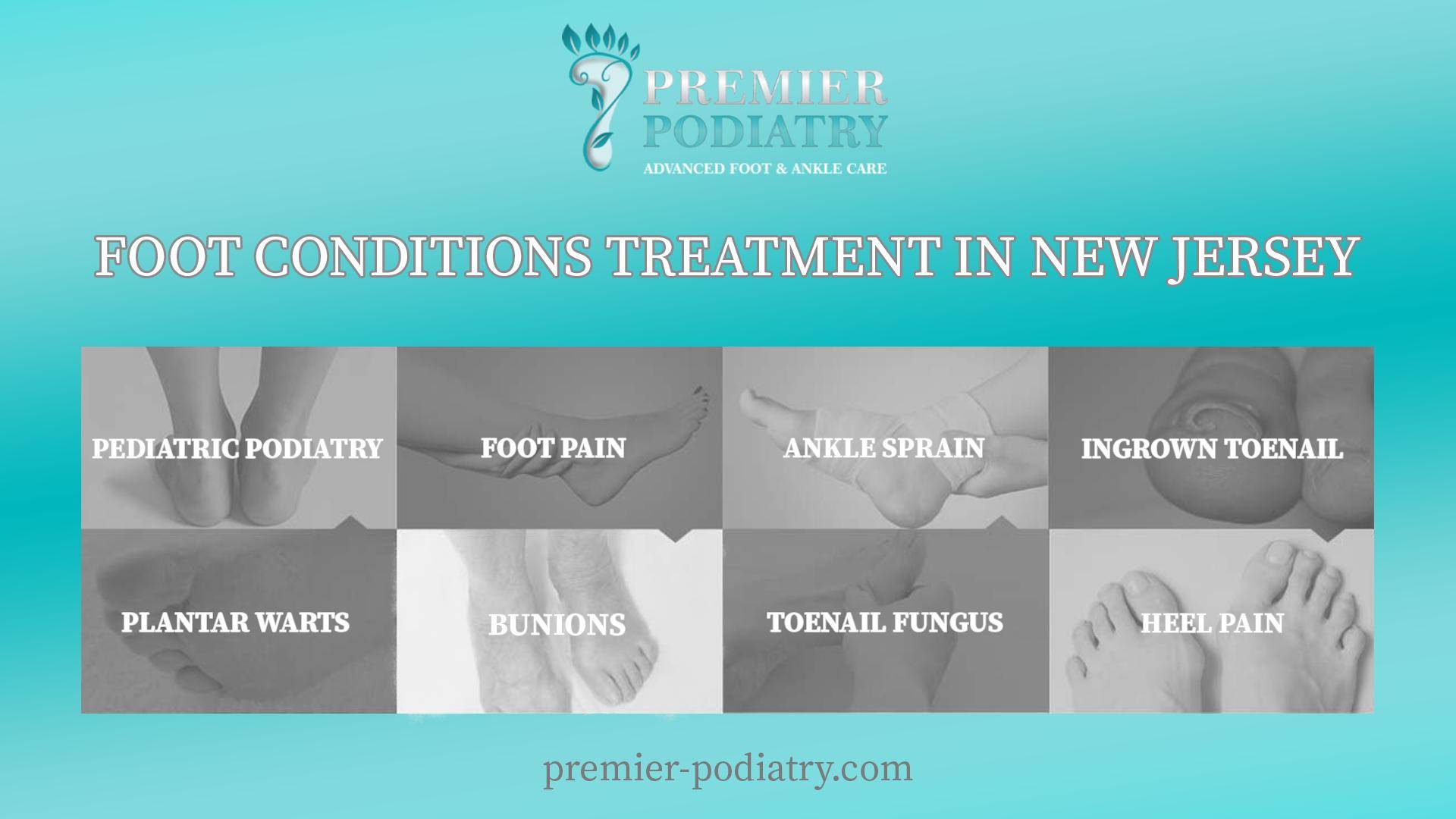 Premier Podiatry | 925 Clifton Ave STE 107, Clifton, NJ 07013, United States | Phone: (973) 315-5555