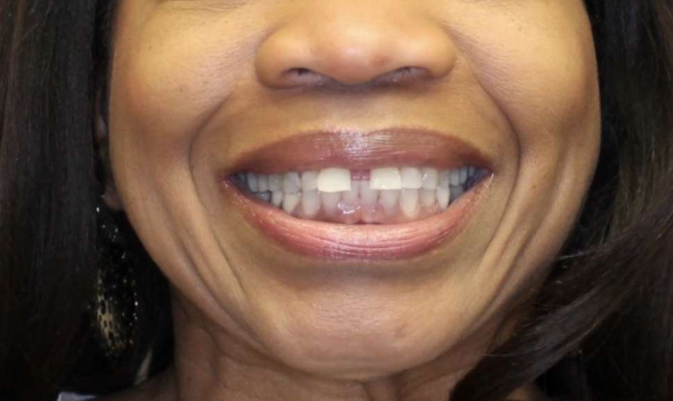 Top Nova Orthodontics | 43170 Southern Walk Plaza # 104, Ashburn, VA 20148, USA | Phone: (703) 724-1199