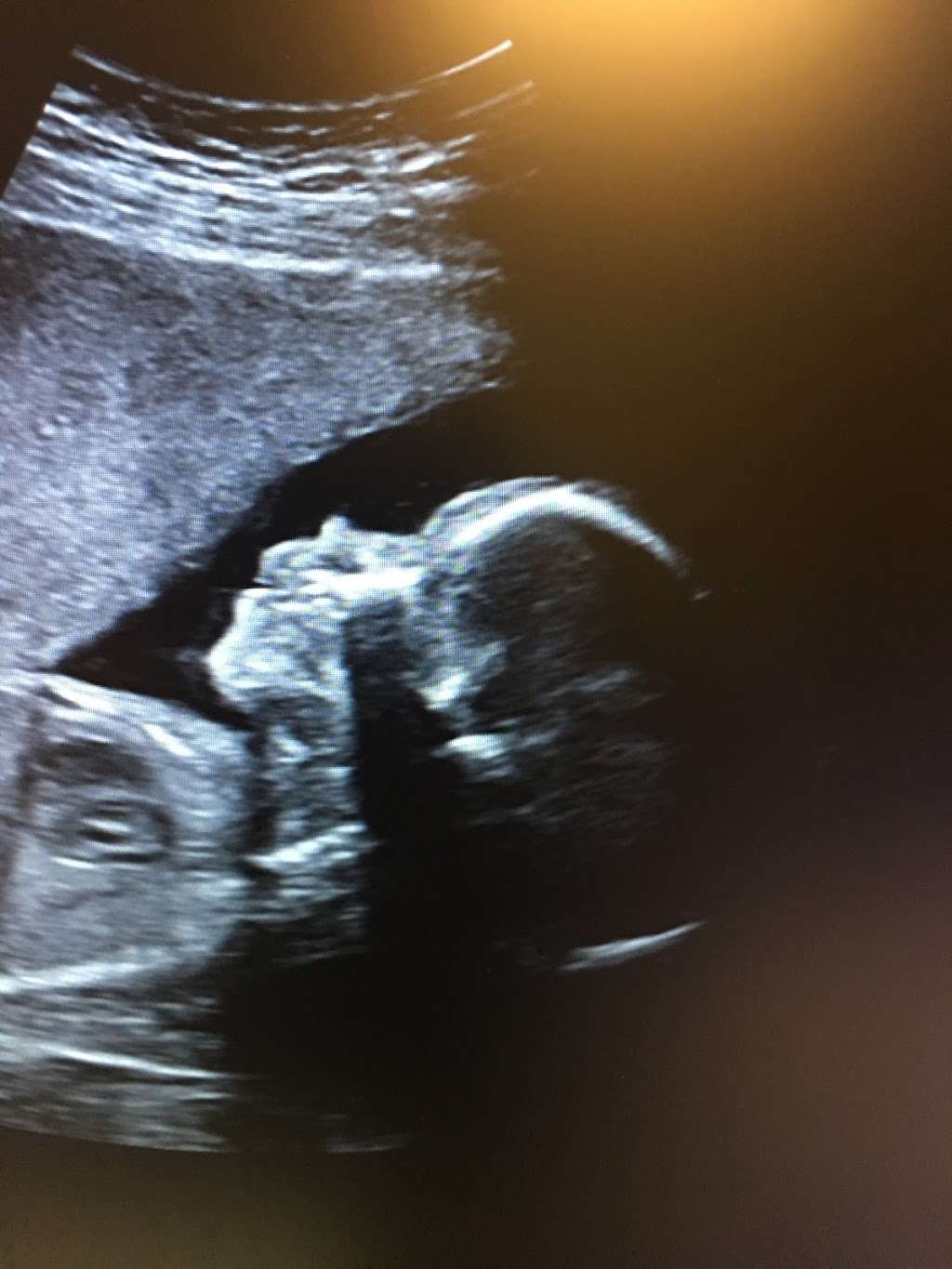 Love View 3D/4D Ultrasound Studio, LLC | 32222 Tamina Rd Suite A5, Magnolia, TX 77354, USA | Phone: (936) 524-9737