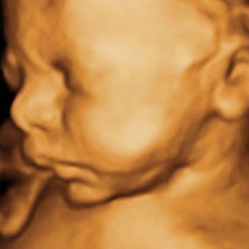 My First Peekaboo Ultrasound | 6233 Durand Ave #102-5, Mt Pleasant, WI 53406, USA | Phone: (262) 554-7775