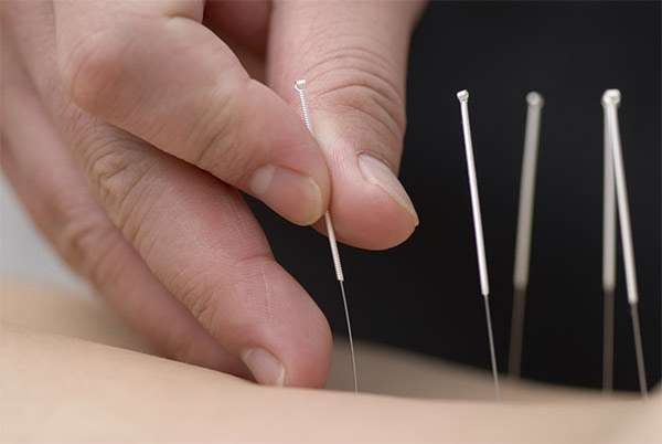Wang Acupuncture Herbs | 7323 Convoy Ct #105, San Diego, CA 92111 | Phone: (858) 831-0338
