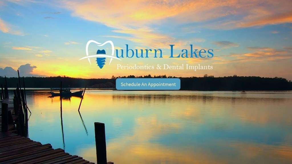 Auburn Lakes Periodontics & Dental Implants | 6922 W Rayford Rd #300, Spring, TX 77389, USA | Phone: (832) 953-3100