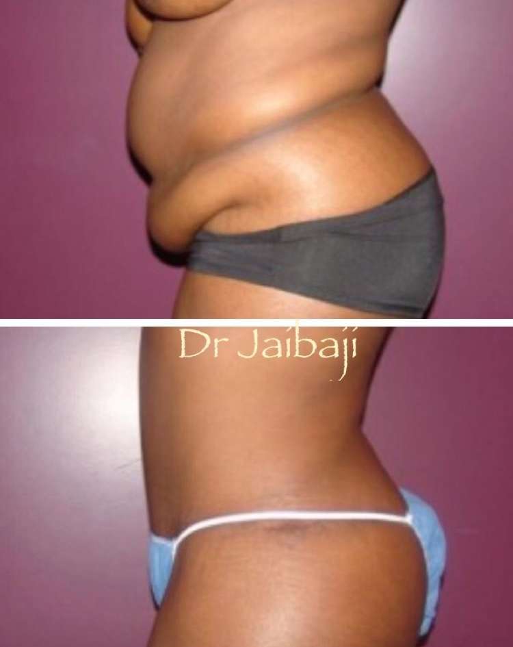 Jaibaji Plastic Surgery | 1001 B Ave Suite 108, Coronado, CA 92118, USA | Phone: (619) 435-1736