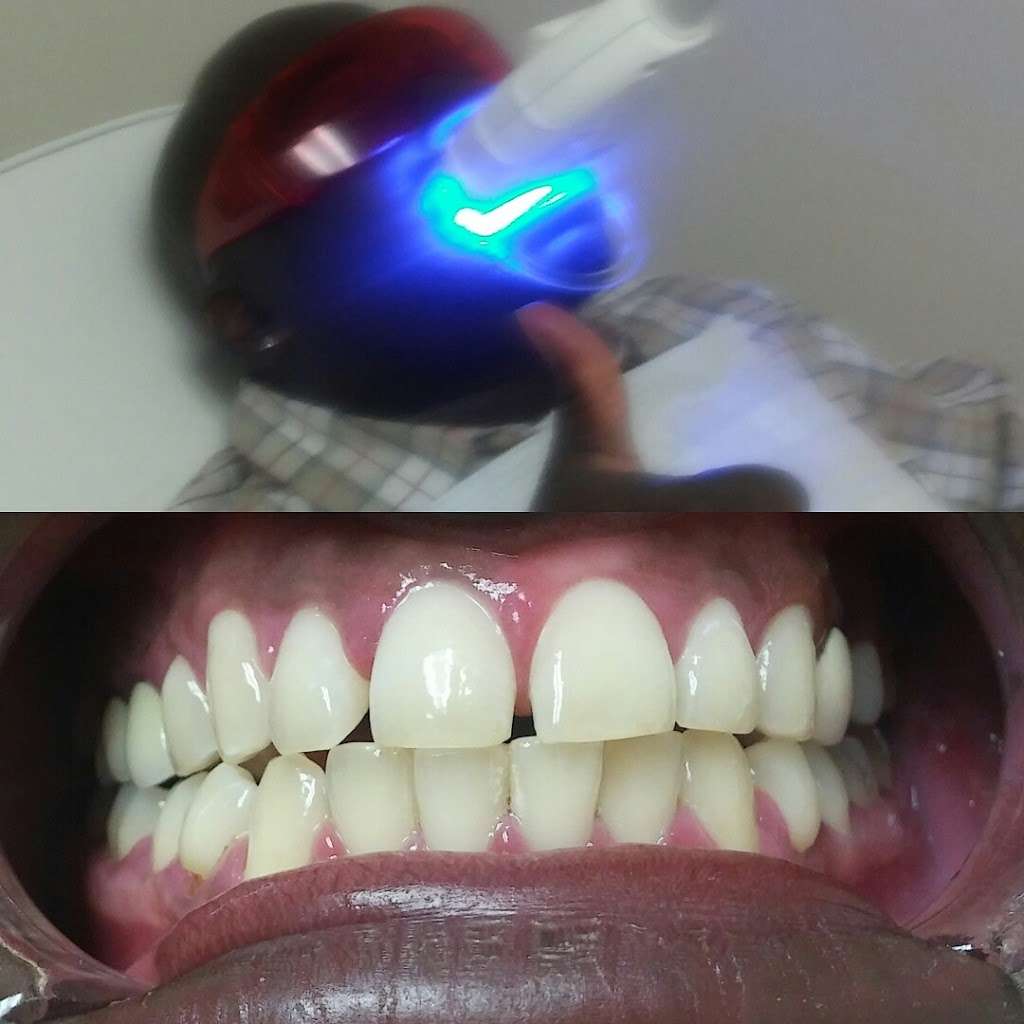 Maui Whitening | 5420 Philadelphia St c, Chino, CA 91710, USA | Phone: (909) 902-5800