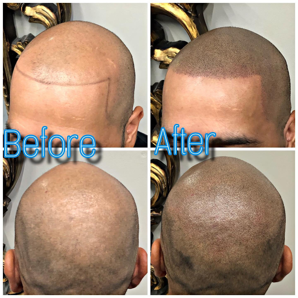 Dallas Scalp Associates | 304 S Cottonwood Dr Ste E, Richardson, TX 75080, USA | Phone: (214) 242-6912