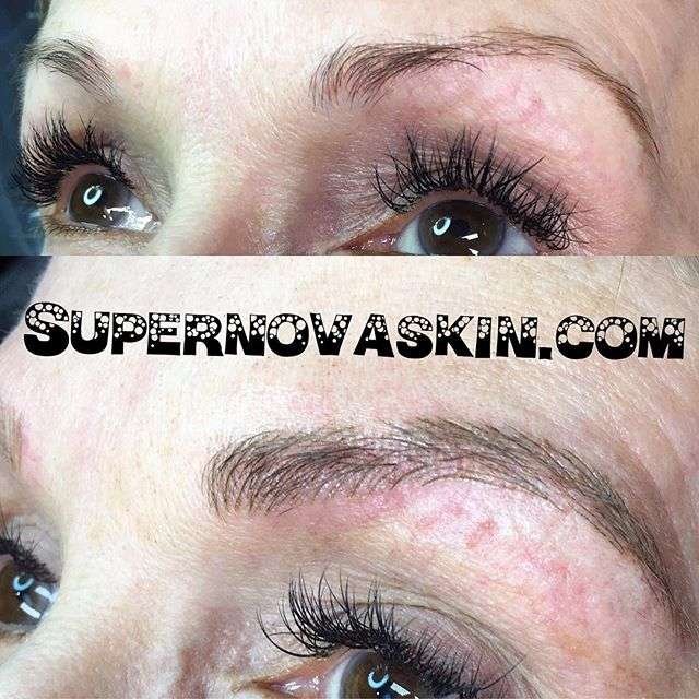 SuperNova Skin | 26400 Kuykendahl Rd Suite C145, Tomball, TX 77375, USA | Phone: (832) 559-0235