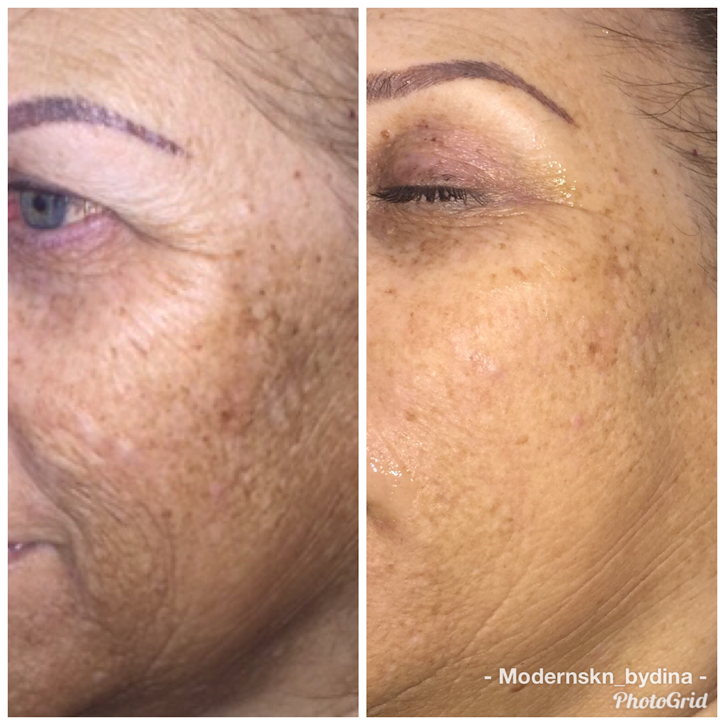 Modern Skin by Dina | 5031 Wagon Trail Ave Unit 110, Las Vegas, NV 89118, USA | Phone: (702) 609-4549