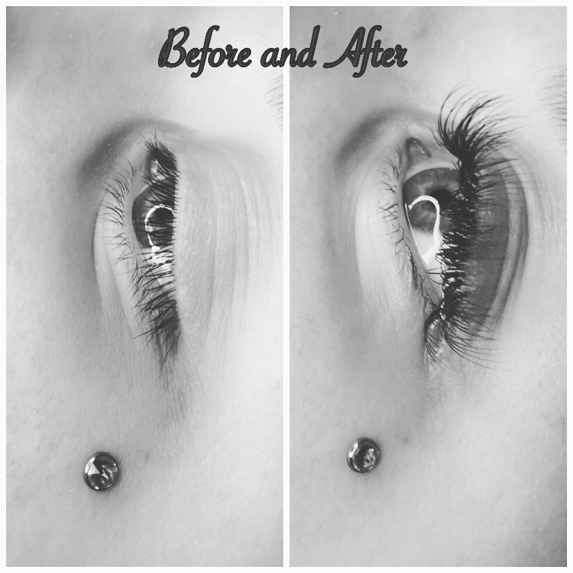 Eiley Esthetics | 1569 Bragaw St STE 205, Anchorage, AK 99508 | Phone: (907) 720-3700