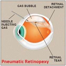 Connecticut Retina Consulants | 4920 Main St #309, Bridgeport, CT 06606, USA | Phone: (203) 365-6565