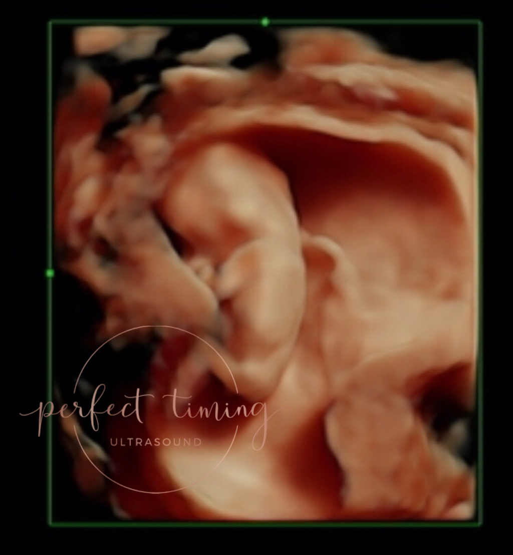 Perfect Timing Ultrasound | 6 Resnik Rd #202, Plymouth, MA 02360, USA | Phone: (508) 591-7956