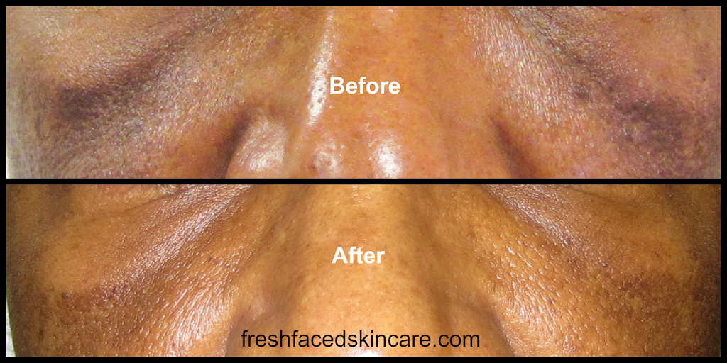 Fresh Faced Skin Care | 328 Kennett Pike #102, Chadds Ford, PA 19317, USA | Phone: (302) 689-3223