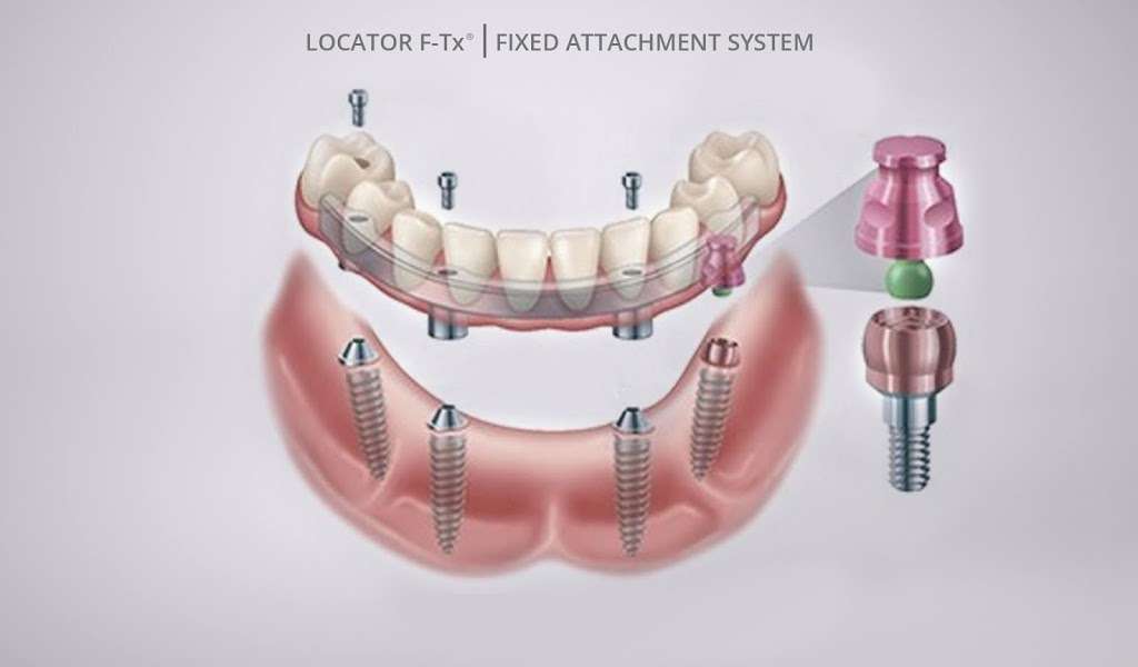 iCad Dental Laboratory | 80 Industrial Rd, Lodi, NJ 07644, USA | Phone: (201) 535-4300