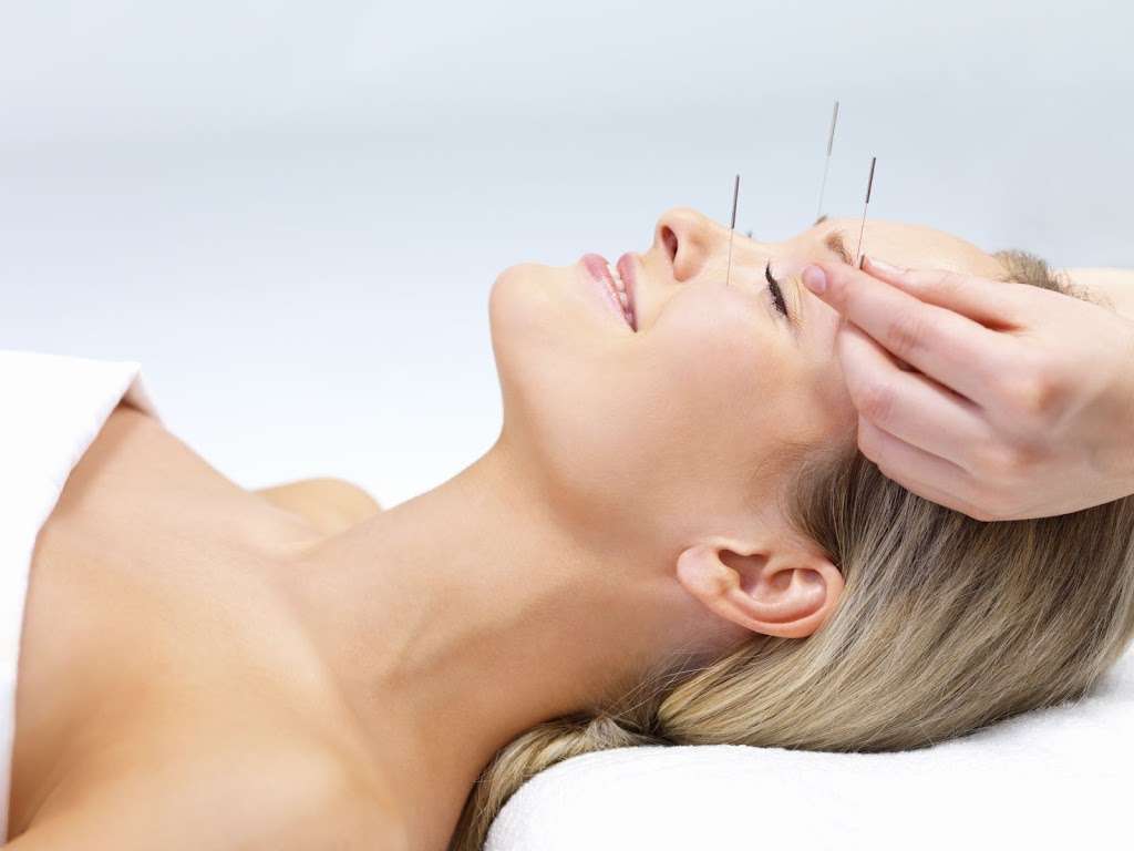 OHM Acupunture | 4303 Ulysses Way, Golden, CO 80403, USA | Phone: (720) 394-4105