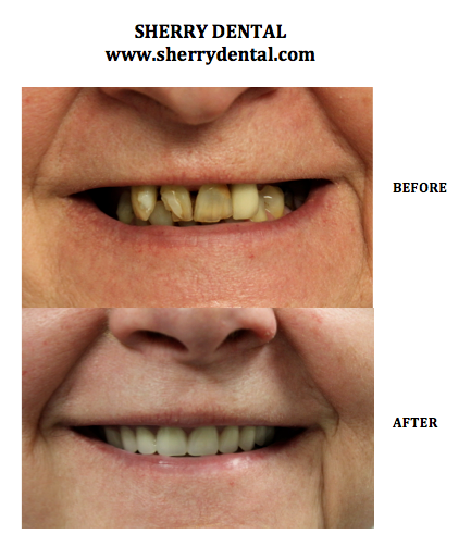 Sherry Dental PC | 41 W Broad St, Tamaqua, PA 18252 | Phone: (570) 668-6200