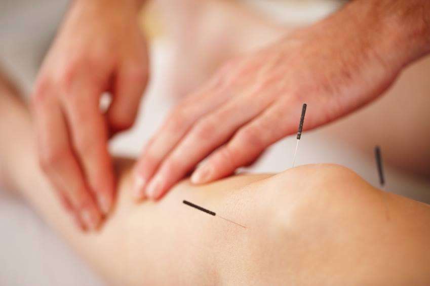 New Life Acupuncture | 1720 S Amphlett Blvd #168, San Mateo, CA 94402 | Phone: (650) 572-1628