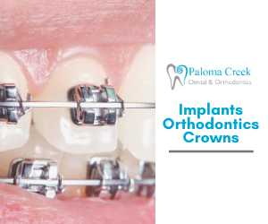 Paloma Creek Dental | 26735 US-380 #105, Aubrey, TX 76227, USA | Phone: (972) 347-1090