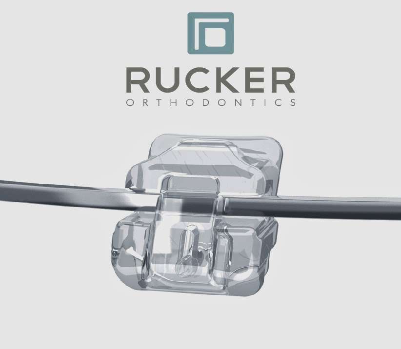 RUCKER ORTHODONTICS | 31560 Rancho Pueblo Rd #201, Temecula, CA 92592, USA | Phone: (951) 302-0685