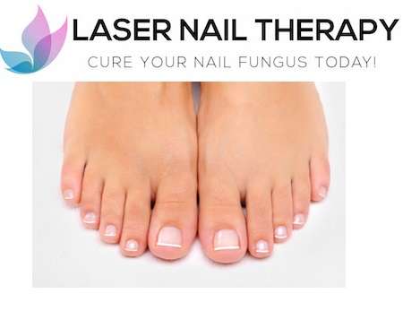 Laser Nail Therapy- Largest Toenail Fungus Treatment Center | 8575 E Princess Dr #221, Scottsdale, AZ 85255, USA | Phone: (800) 672-0625