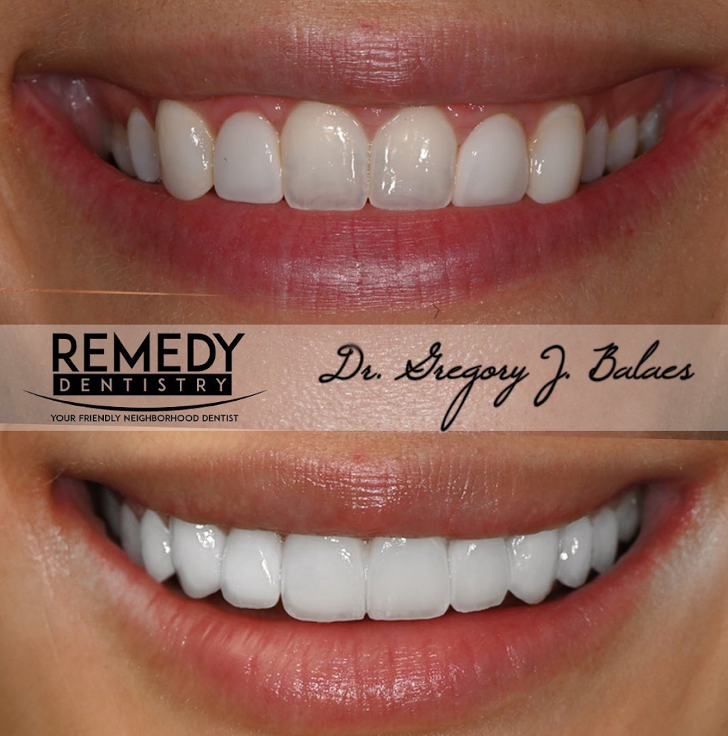 Remedy Dentistry: Cosmetic and General Dentist | 932 Woodrow Rd, Staten Island, NY 10312, USA | Phone: (718) 747-8711