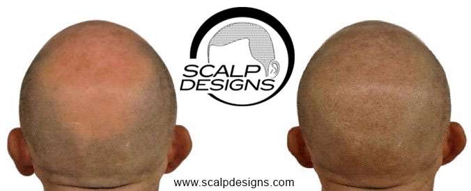 Scalp Designs | 1595 Central St, Stoughton, MA 02072, USA | Phone: (508) 505-8106