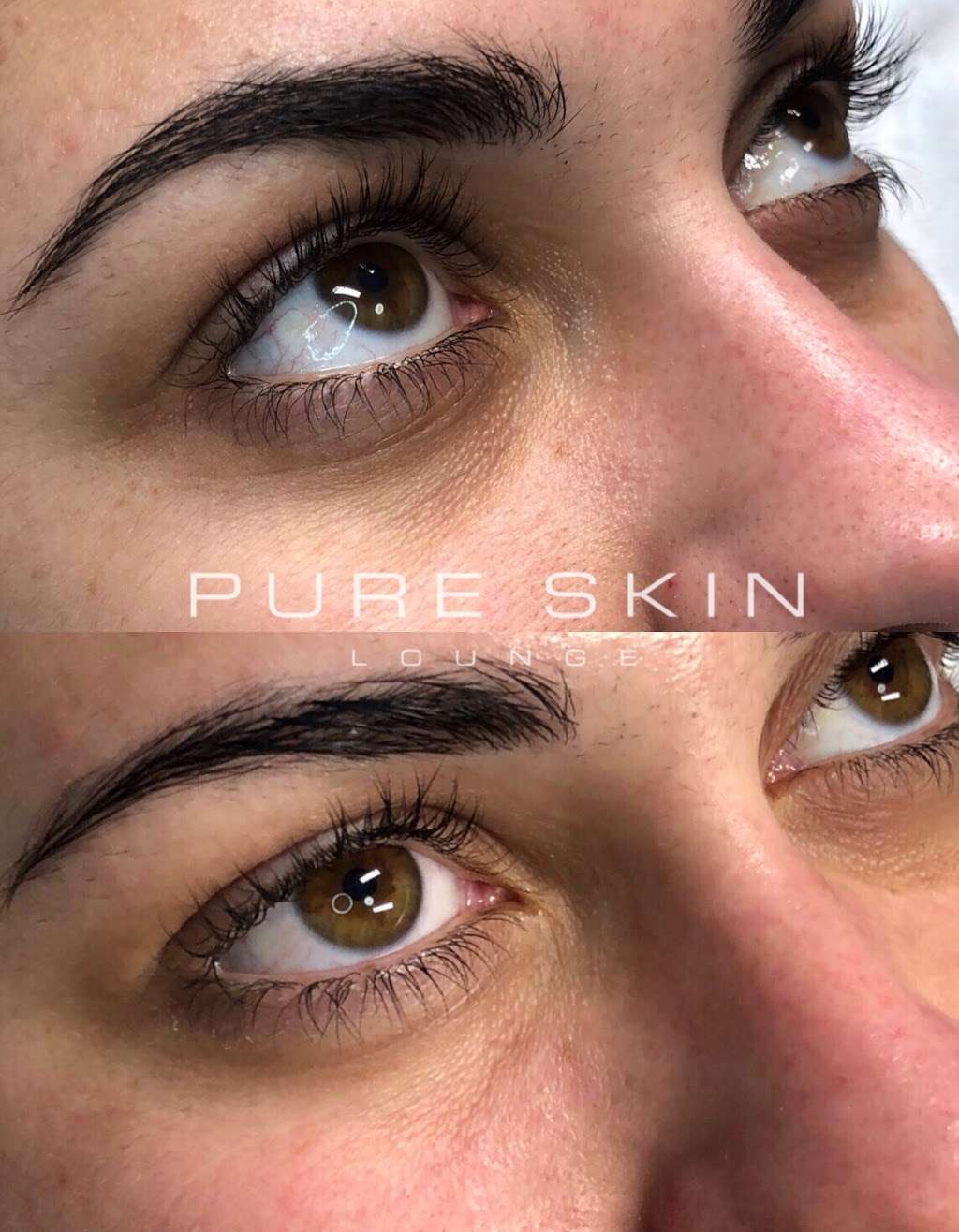 Pure Skin Lounge | 1425 University Ave Ste B, San Diego, CA 92103, USA | Phone: (619) 354-6826