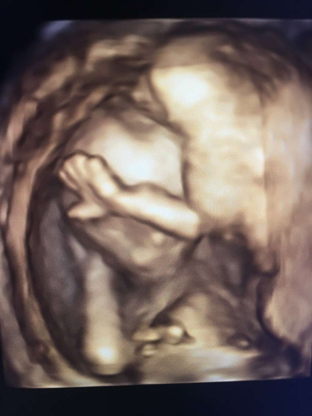 Love View 3D/4D Ultrasound Studio, LLC | 32222 Tamina Rd Suite A5, Magnolia, TX 77354, USA | Phone: (936) 524-9737