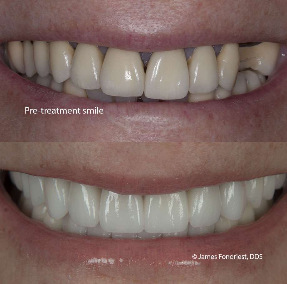 James Fondriest DDS, FACD, FICD | 560 Oakwood Ave #200, Lake Forest, IL 60045, USA | Phone: (847) 234-0517