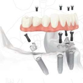 Smiles By Hazen - Mount Dora Family Dentistry and Orthodontics | 19001 US-441, Mt Dora, FL 32757, USA | Phone: (352) 383-9406