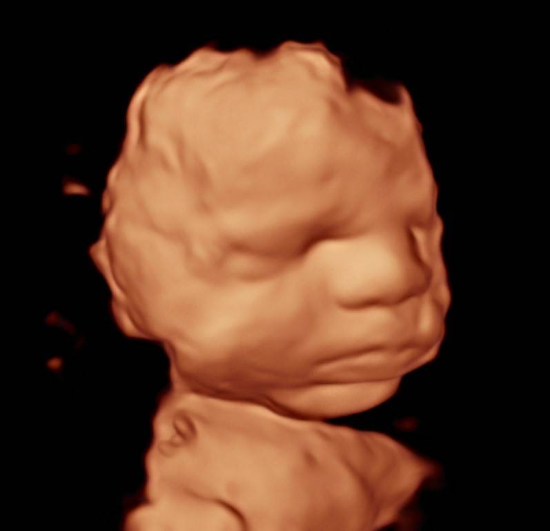 4 Babies Ultrasound | 34995 Yucaipa Blvd, Yucaipa, CA 92399, USA | Phone: (909) 351-6496