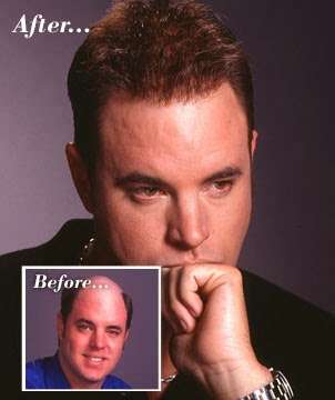 HRStudio - Hair Restoration Solutions | 605 Main Ave, Minneola, FL 34715, USA | Phone: (407) 902-4883