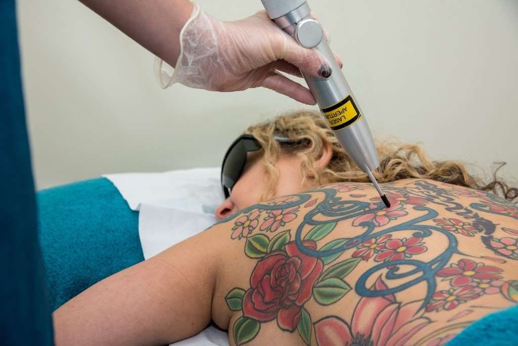 The Avalon Laser Clinic | 1 Chislehurst Rd, Orpington BR6 0DF, UK | Phone: 01689 837546