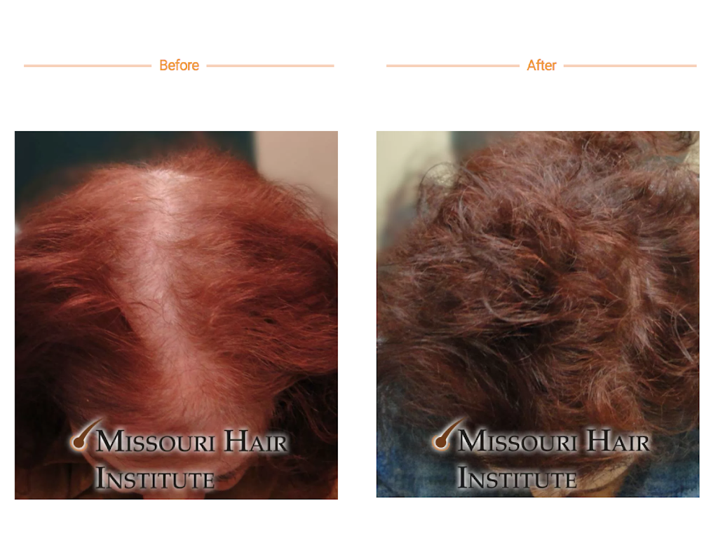 Missouri Hair Institute | 556 Rush Creek Parkway #B2, Liberty, MO 64068 | Phone: (816) 792-3400