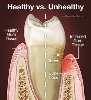 Plano Top Dental | 8000 Coit Rd #200, Plano, TX 75025, USA | Phone: (469) 362-8088