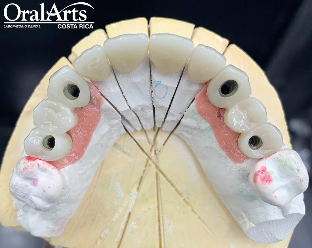 Reliable Arts Dental Lab | 6955 NW 52nd St Unit 1, Miami, FL 33166, USA | Phone: (866) 978-5274