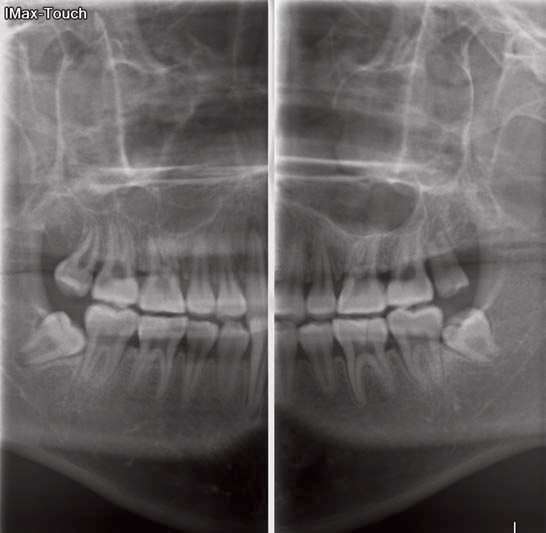 Sodium Dental X-ray Sensor Repair | 1100 N Hartley St Suite 300, York, PA 17404, USA | Phone: (800) 821-8962
