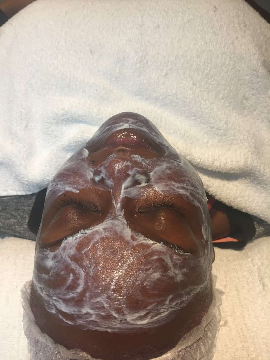 SoulBeautiful Skin | 9605 L, N Tryon St, Charlotte, NC 28262, USA | Phone: (980) 275-1077
