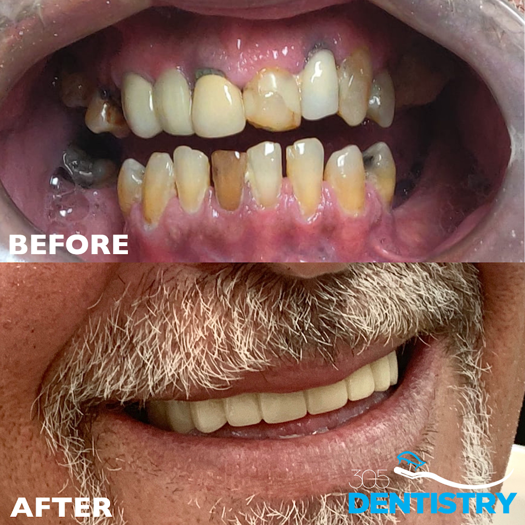 305 Dentistry | 3850 SW 87th Ave #101, Miami, FL 33165 | Phone: (305) 226-8236