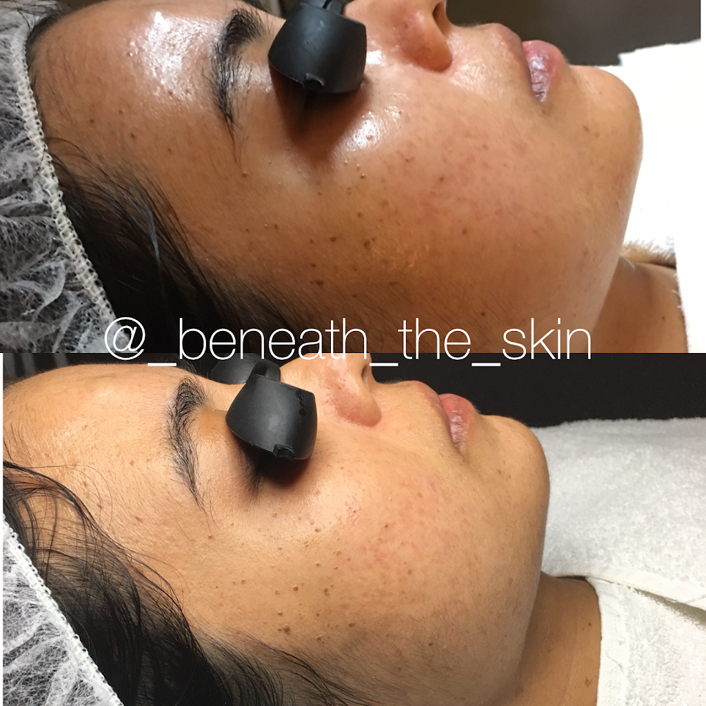 Beneath the Skin ~ Corrective Skincare Solutions | 8480 Baltimore National Pike #318, Ellicott City, MD 21043, USA | Phone: (301) 971-2769