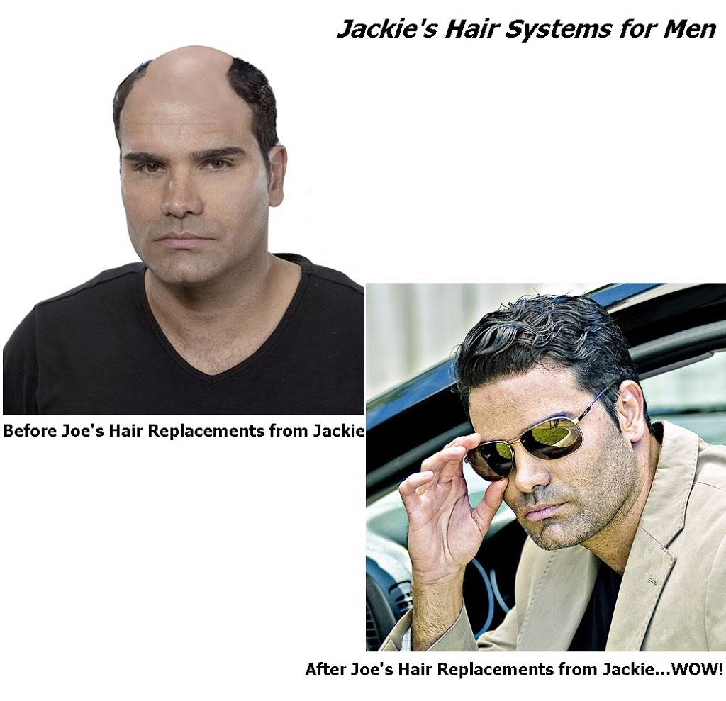 Jackies Hair Systems | 30242 Crown Valley Pkwy, Laguna Niguel, CA 92677, USA | Phone: (714) 401-5238