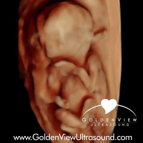 Goldenview Ultrasound 3d/4d/HD San Antonio | 11825 Interstate 10 west suite 201, San Antonio, TX 78230, USA | Phone: (888) 915-2229