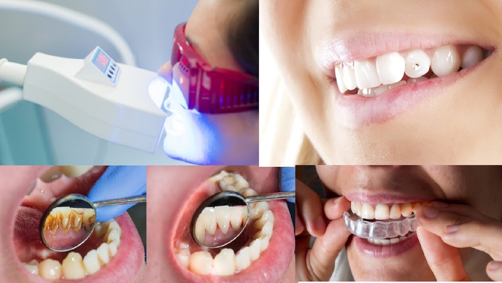 Revive Teeth Whitening Spa | Inside Phenix Salon Suites (next to Souper Salad 1017 N. Central Expy #200 Suite #104, Plano, TX 75075, USA | Phone: (214) 556-0835