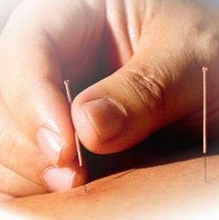 Acupuncture Medical Center | 30212 Tomas #180, Rancho Santa Margarita, CA 92688, USA | Phone: (949) 206-1040