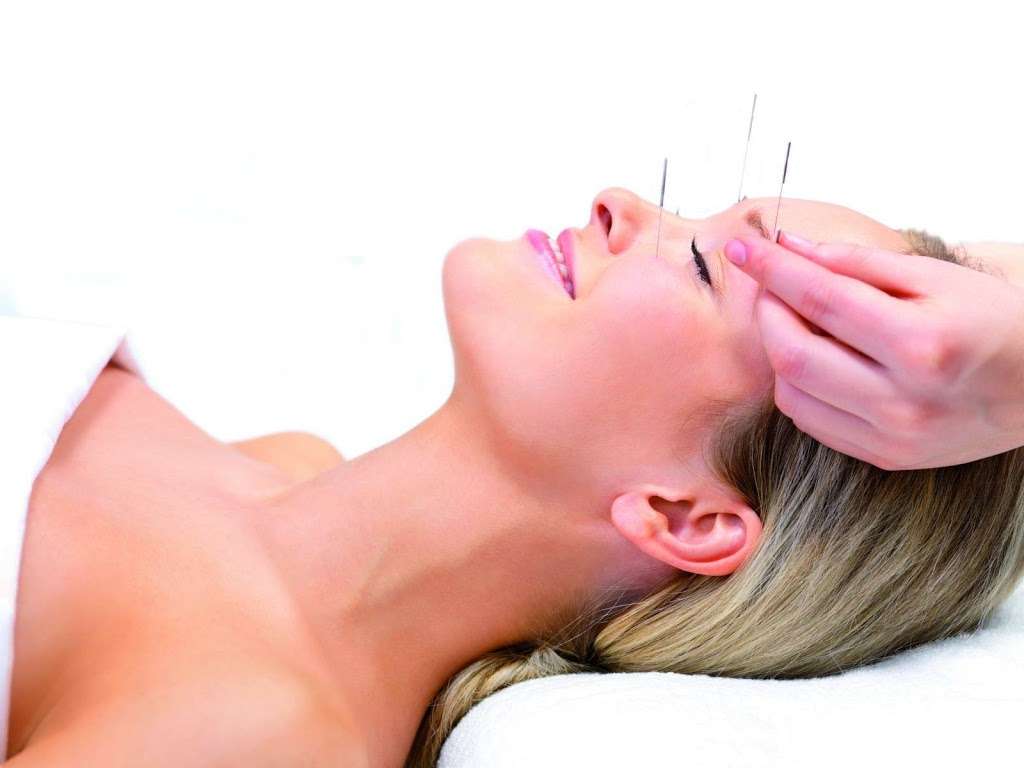 Acupuncture & Natural Health | station house, Old Horsham Rd, Beare Green, Dorking RH2 0DR, UK | Phone: 07793 451845