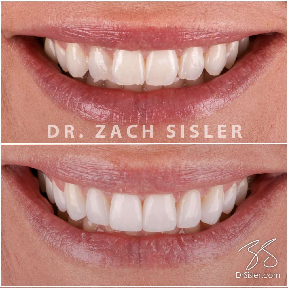 Smile Design by Sisler | 1020 Orrstown Rd, Shippensburg, PA 17257, USA | Phone: (717) 532-8740